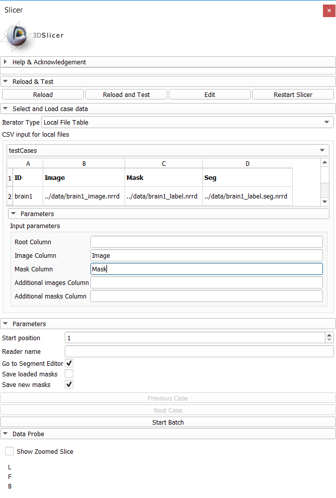 Screenshot 1 (CSV Table: local files)